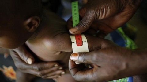 DR Congo’s economy loses over $1 billion to child undernutrition, finds UN-backed study