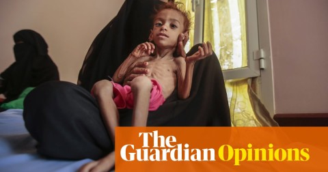 A woman holds a malnourished boy at the Aslam Health Center, in Hajjah, Yemen, 1 October 2018. 1.8 million children in the country are severely malnourished. Photo: Hani Mohammed/AP