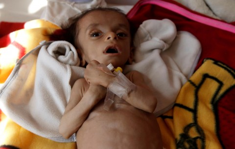 UN chief Antonio Guterres calls for an immediate ceasefire in Yemen